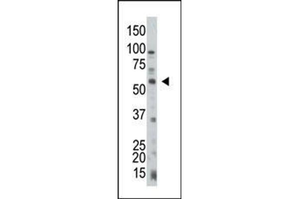 PTEN anticorps  (C-Term)