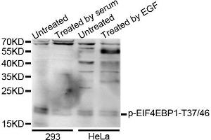 Western blot analysis of extracts of various cells, using Phospho-EIF4EBP1-T37/46 antibody. (eIF4EBP1 anticorps  (pThr36))