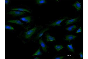 Immunofluorescence of purified MaxPab antibody to EIF4B on HeLa cell. (EIF4B anticorps  (AA 1-611))