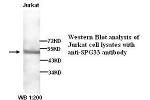 Image no. 1 for anti-Zinc Finger, FYVE Domain Containing 27 (ZFYVE27) antibody (ABIN790894) (ZFYVE27 anticorps)