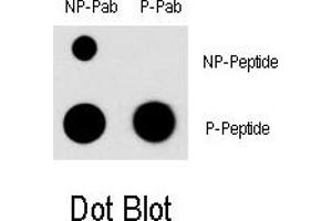 Image no. 1 for anti-Myocyte Enhancer Factor 2C (MEF2C) (pSer396) antibody (ABIN5552137) (MEF2C anticorps  (pSer396))