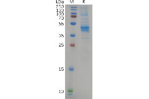 Human Protein, hFc Tag on SDS-PAGE under reducing condition. (CCR6 Protein (AA 1-47) (Fc Tag))