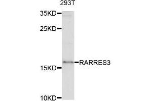 Western blot analysis of extracts of 293T cells, using RARRES3 antibody (ABIN5995728) at 1/1000 dilution. (RARRES3 anticorps)