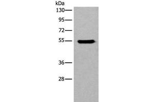 Western blot analysis of HEPG2 cell lysate using CYP11B2 Polyclonal Antibody at dilution of 1:650 (CYP11B2 anticorps)