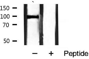 Western blot analysis of Catenin α1 expression in mouse muscle tissue lysates,The lane on the right is treated with the antigen-specific peptide. (CTNNA1 anticorps  (C-Term))