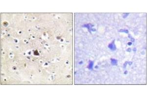 Immunohistochemistry analysis of paraffin-embedded human brain tissue, using GR (Ab-226) Antibody. (GR (AA 201-250) anticorps)