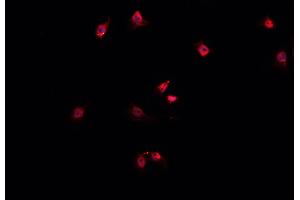 ABIN6269388 staining A549 cells by IF/ICC. (CPI-17 anticorps  (Internal Region))