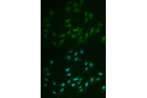 Immunofluorescence analysis of MCF-7 cells using LIG1 antibody. (LIG1 anticorps)