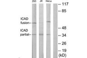 Western Blotting (WB) image for anti-DNA Fragmentation Factor, 45kDa, alpha Polypeptide (DFFA) (AA 151-200) antibody (ABIN2889986) (DFFA anticorps  (AA 151-200))