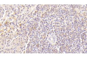 Detection of GM-CSF in Human Spleen Tissue using Polyclonal Antibody to Colony Stimulating Factor 2, Granulocyte Macrophage (GM-CSF) (GM-CSF anticorps  (AA 18-144))