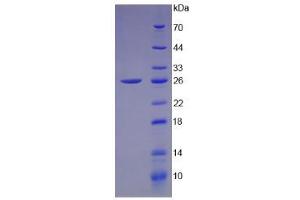 SDS-PAGE analysis of Human Connexin 43 Protein. (Connexin 43/GJA1 Protéine)