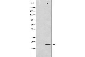 Western blot analysis of Cofilin expression in COLO205 whole cell lysates,The lane on the left is treated with the antigen-specific peptide. (Cofilin anticorps  (N-Term))
