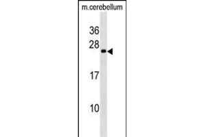 Mouse BAD Antibody (Center //) (ABIN6243058 and ABIN6577363) western blot analysis in mouse cerebellum tissue lysates (35 μg/lane). (BAD anticorps  (AA 90-118))