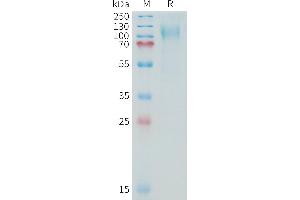 Human (13810-14451) Protein, His Tag on SDS-PAGE under reducing condition. (MUC16 Protein (AA 13810-14451) (His tag))