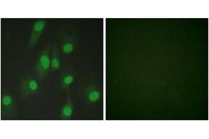 Immunofluorescence analysis of HeLa cells, using Chk1 (Ab-286) Antibody. (CHEK1 anticorps  (AA 256-305))