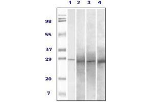 Western blot analysis using Rab25 antibody against truncated Rab25 recombinant protein (1), human overy carcinoma (2), stomach carcinoma (3), breast carcinoma (4) tissue lysate. (RAB25 anticorps)