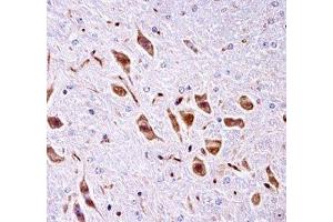 PAK3 antibody immunohistochemistry analysis in formalin fixed and paraffin embedded mouse brain tissue. (PAK3 anticorps  (AA 124-152))