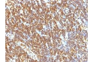 Immunohistochemistry (Formalin-fixed Paraffin-embedded Sections) (IHC (fp)) image for anti-Small Ubiquitin Related Modifier 2 (SUMO2) antibody (ABIN3026258)