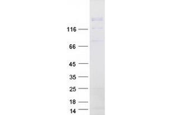 TIAM1 Protein (Myc-DYKDDDDK Tag)