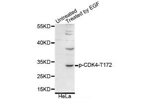 Western blot analysis of extracts of various cell lines, using Phospho-CDK4-T172 antibody (ABIN5995651). (CDK4 anticorps  (pThr172))