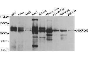 Western blot analysis of extracts of various cell lines, using ANKRD52 antibody (ABIN5974842) at 1/1000 dilution. (ANKRD52 anticorps)