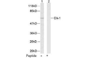 Image no. 2 for anti-ELK1, Member of ETS Oncogene Family (ELK1) (Ser383) antibody (ABIN197098) (ELK1 anticorps  (Ser383))