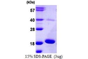 SDS-PAGE (SDS) image for Anterior Gradient 3 (AGR3) (AA 22-166) protein (His tag) (ABIN667477) (AGR3 Protein (AA 22-166) (His tag))