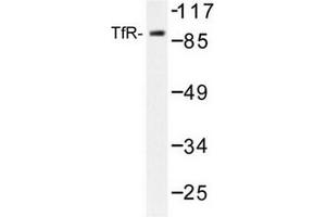 Image no. 2 for anti-Transferrin Receptor (p90, CD71) (TFRC) antibody (ABIN272097) (Transferrin Receptor anticorps)