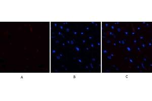 Immunofluorescence analysis of rat heart tissue. (E2F1 anticorps  (AA 100-170))