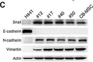 Western Blotting (WB) image for anti-Vimentin (VIM) antibody (ABIN2854814)