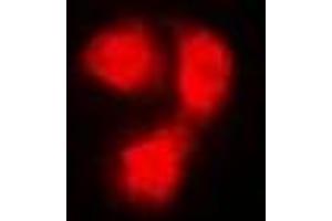 Immunofluorescent analysis of Beta 2 Microglobulin staining in Hela cells. (beta-2 Microglobulin anticorps)