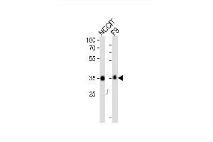 Western blot analysis of lysates from NCCIT, mouse F9 cell line (from left to right), using Sox2 Antibody (N-term) (ABIN6243281 and ABIN6577707). (SOX2 anticorps  (N-Term))