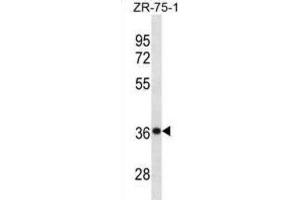 Western Blotting (WB) image for anti-Cysteine and Histidine-Rich Domain (CHORD)-Containing 1 (CHORDC1) antibody (ABIN3001211) (CHORDC1 anticorps)