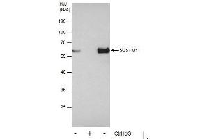 Immunoprecipitation (IP) image for anti-Sequestosome 1 (SQSTM1) antibody (ABIN2854836)