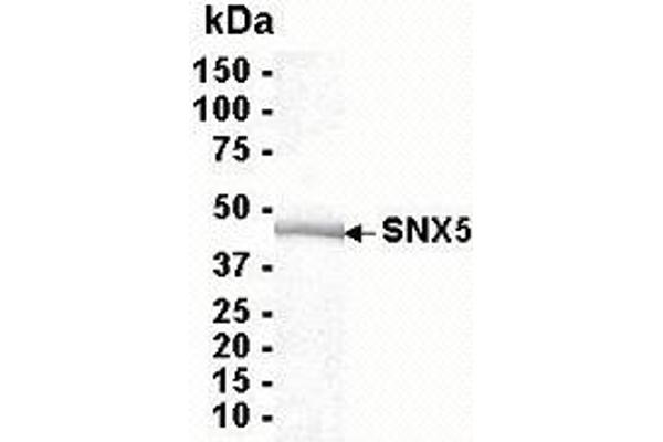 SNX5 Protein (AA 1-404)