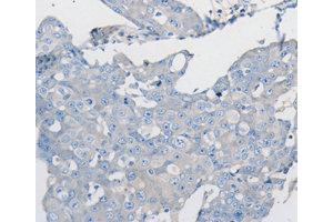 Immunohistochemistry (IHC) image for anti-Protein Phosphatase 2, Catalytic Subunit, beta Isozyme (PPP2CB) antibody (ABIN1874224) (PPP2CB anticorps)