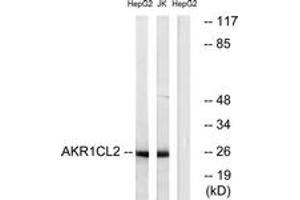Western blot analysis of extracts from HepG2/Jurkat cells, using AKR1CL2 Antibody. (AKR1E2 anticorps  (AA 141-190))