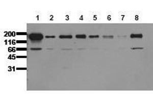 Western Blotting (WB) image for anti-Epidermal Growth Factor Receptor (EGFR) (C-Term) antibody (ABIN126786) (EGFR anticorps  (C-Term))