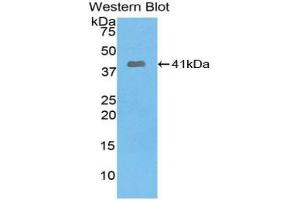 Western blot analysis of the recombinant protein. (PYGO1 anticorps  (AA 201-419))