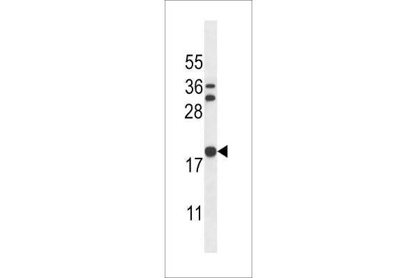 Stathmin 3 anticorps  (C-Term)