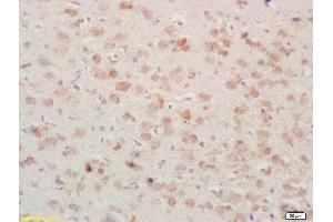 Formalin-fixed and paraffin embedded rat brain tissue labeled Anti-PSAP/PAP Polyclonal Antibody, Unconjugated (ABIN735773) at 1:200, followed by conjugation to the secondary antibody and DAB staining (Prosaposin anticorps  (AA 101-200))