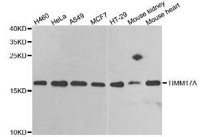 Western blot analysis of extracts of various cell lines, using TIMM17A antibody. (TIMM17A anticorps  (AA 1-171))