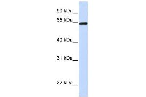 LCP1 antibody used at 1 ug/ml to detect target protein. (LCP1 anticorps)