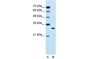 SBDS antibody used at 1. (SBDS anticorps  (C-Term))