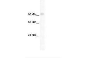 Image no. 1 for anti-Phosphoinositide-3-Kinase, Catalytic, beta Polypeptide (PIK3CB) (C-Term) antibody (ABIN202970) (PIK3CB anticorps  (C-Term))