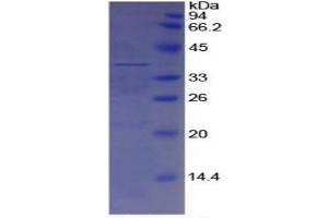 SDS-PAGE (SDS) image for Apolipoprotein H (Beta-2-Glycoprotein I) (APOH) ELISA Kit (ABIN6730893)