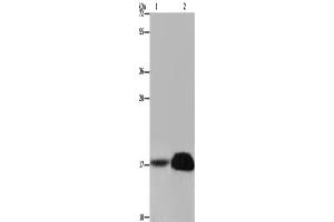 Western Blotting (WB) image for anti-Fragile Histidine Triad (FHIT) antibody (ABIN2423468) (FHIT anticorps)