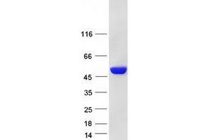 Validation with Western Blot (Glucose-6-Phosphate Dehydrogenase Protein (G6PD) (Transcript Variant 2) (Myc-DYKDDDDK Tag))