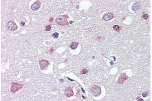 Human Brain, Cortex (formalin-fixed, paraffin-embedded) stained with FEZ1 antibody ABIN462288 followed by biotinylated anti-goat IgG secondary antibody ABIN481715, alkaline phosphatase-streptavidin and chromogen. (FEZ1 anticorps  (AA 278-290))