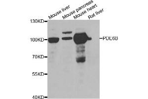 Western blot analysis of extracts of various cell lines, using PDE6B antibody (ABIN5975450) at 1/1000 dilution. (PDE6B anticorps)